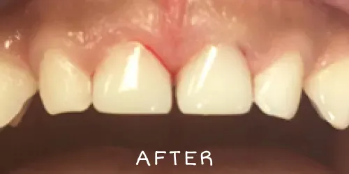 After image