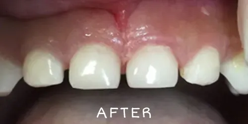 After image