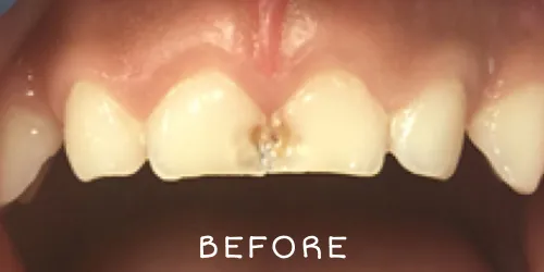 Before image
