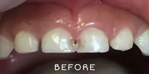 Before image